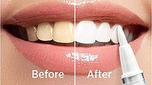 Load image into Gallery viewer, Whitely Teeth Whitening Pen